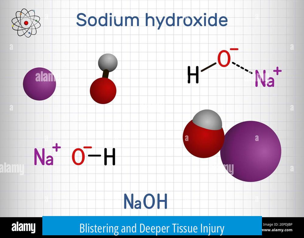Blistering and Deeper Tissue Injury
