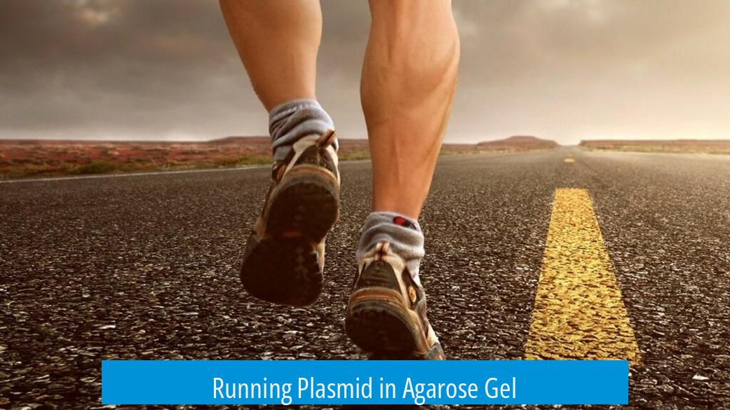 Running Plasmid in Agarose Gel